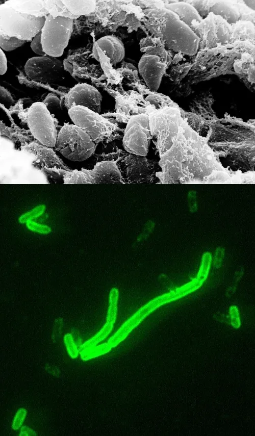 Yersinia_pestis_fluorescent.jpeg-imageonline.co-merged.webp